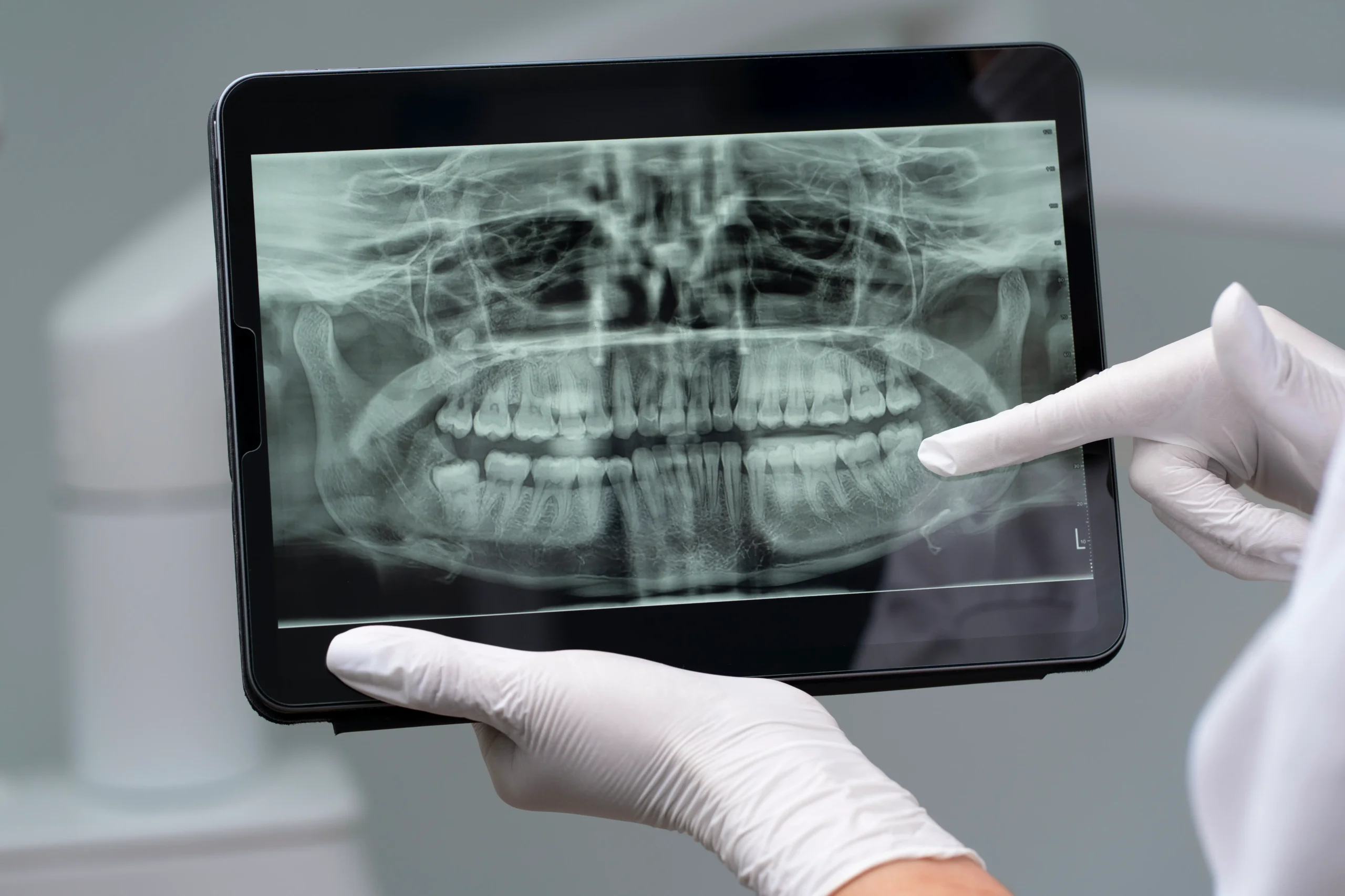 un-primer-plano-de-los-instrumentos-dentales-radiografia
